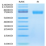 Biotinylated Human EGFRVIII Protein (EG8-HM154B)