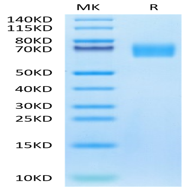 Biotinylated Human EGFRVIII Protein (EG8-HM154B)