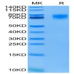FITC-Labeled Human EGFRVIII Protein (EG8-HM154F)