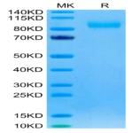 Rhesus macaque EGFR Protein (EGF-CM101)