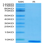 Human EGF Protein (EGF-HE001)