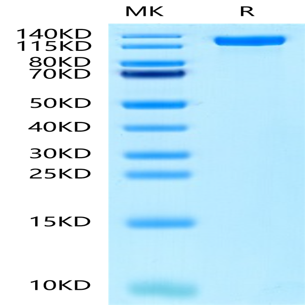 Human EGFR/HER1 Protein (EGF-HM201)