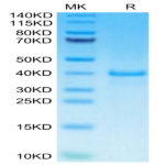 Human EGF Protein (EGF-HM202)