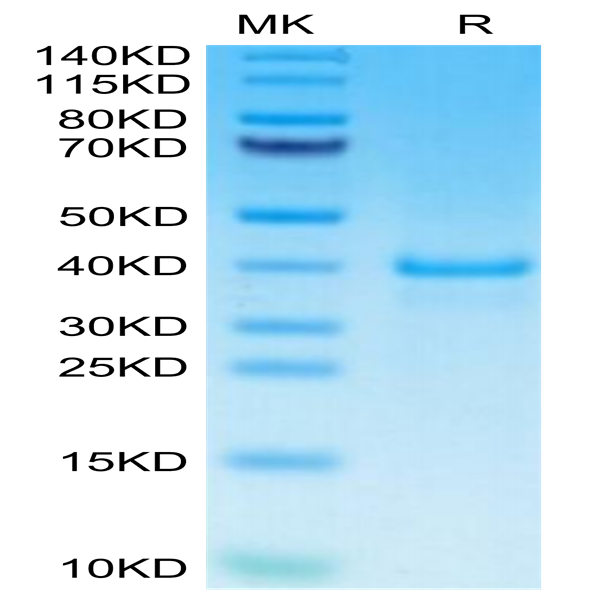 Human EGF Protein (EGF-HM202)