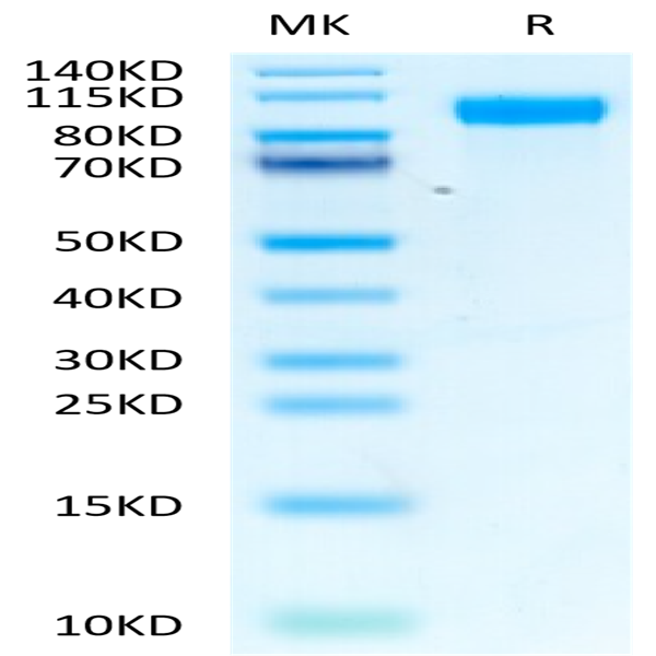 Biotinylated Human EGFR/HER1 Protein (EGF-HM401B)