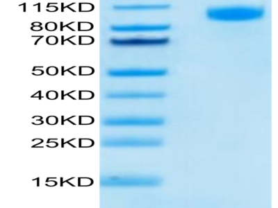 FITC-Labeled Human EGFR/HER1 Protein (EGF-HM401F)