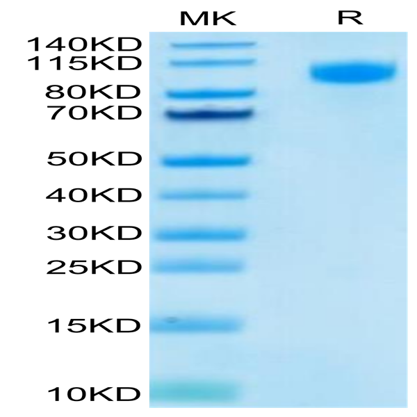 FITC-Labeled Human EGFR/HER1 Protein (EGF-HM401F) FITC-Labeled Human EGFR/HER1 Protein (EGF-HM401F)