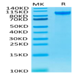 Human ENPP-2/Autotaxin Protein (ENP-HM101)