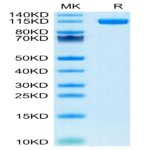 Human ENPP-1 Protein (ENP-HM102)