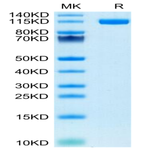 Human ENPP-1 Protein (ENP-HM102)