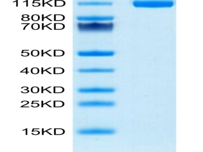 Human ENPP-1 Protein (ENP-HM102)