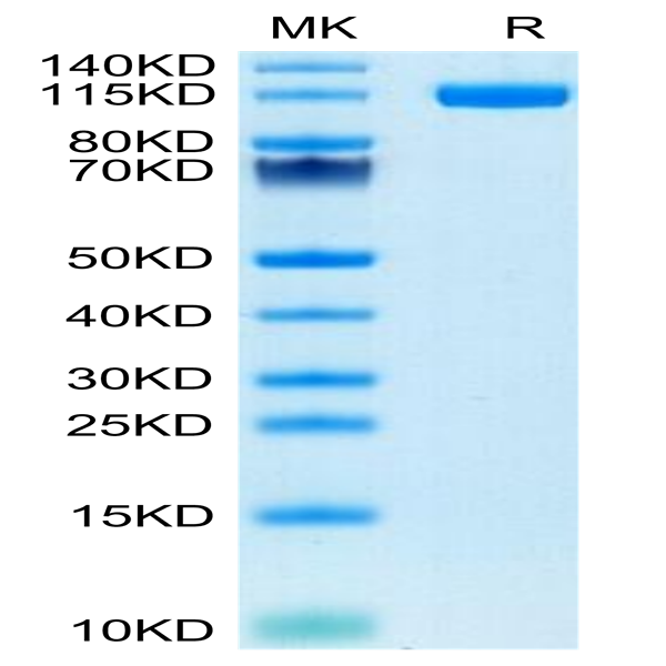 Human ENPP-1 Protein (ENP-HM102) Human ENPP-1 Protein (ENP-HM102)