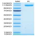 Human ENPP-1 Protein (ENP-HM103)