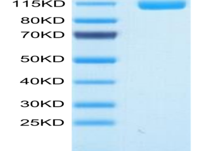 Human ENPP-1 Protein (ENP-HM103)