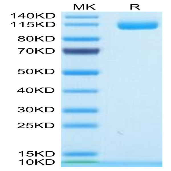 Human ENPP-1 Protein (ENP-HM103) Human ENPP-1 Protein (ENP-HM103)