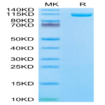 Biotinylated Human ENPP-1 Protein (ENP-HM402B)