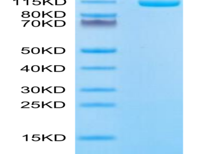 Biotinylated Human ENPP-1 Protein (ENP-HM402B)