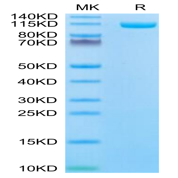 Biotinylated Human ENPP-1 Protein (ENP-HM402B) Biotinylated Human ENPP-1 Protein (ENP-HM402B)
