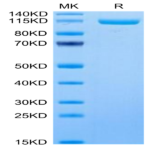 Human ENPP-3 Protein (ENP-HM403)