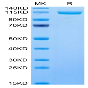 Human ENPP-3 Protein (ENP-HM403)
