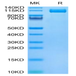 Biotinylated Human ENPP-3 Protein (ENP-HM403B)