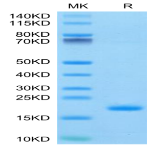 Human ENPP-3 (48-157) Protein (ENP-HM404)