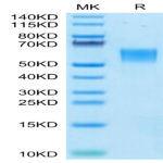 Human ENPP-3 (558-875) Protein (ENP-HM406)