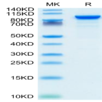 Mouse ENPP-2/Autotaxin Protein (ENP-MM101)