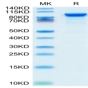 Mouse ENPP-2/Autotaxin Protein (ENP-MM101)