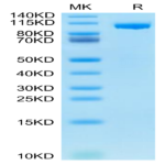 Mouse ENPP-1 Protein (ENP-MM102)