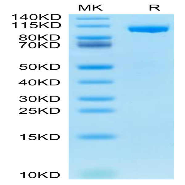 Mouse ENPP-1 Protein (ENP-MM102) Mouse ENPP-1 Protein (ENP-MM102)