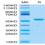 Human Ephrin-A4/EFNA4 Protein (EPA-HM204)