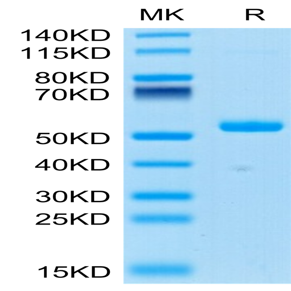 Human Ephrin-A4/EFNA4 Protein (EPA-HM204)