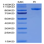 Cynomolgus EPHA2 Protein (EPH-CM2A2)