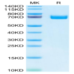 Human EPHB2 Protein (EPH-HM101)