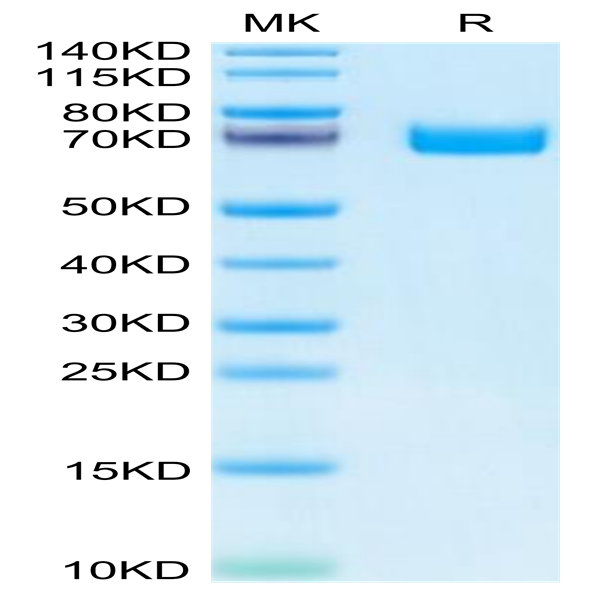 Human EPHB2 Protein (EPH-HM101)
