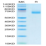 Human EPHA10 Protein (EPH-HM110)