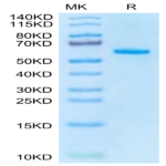 Human EPHA2 Protein (EPH-HM1A2)