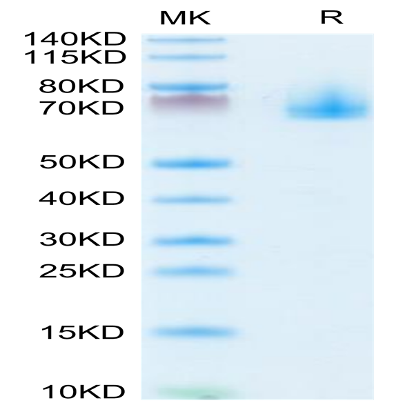 Mouse EPHA10 Protein (EPH-MM110)