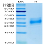 Human EMMPRIN/CD147 Protein (EPN-HM147)