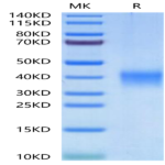 Human EPO/Erythropoietin Protein (EPO-HM001)