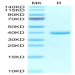 Human EREG Protein (ERE-HM201)
