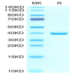 Mouse EREG Protein (ERE-MM201)