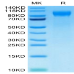 Cynomolgus E-selectin/CD62E Protein (ESE-CM101)