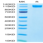 Human E-Selectin/CD62E Protein (ESE-HM201)