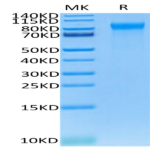 Human E-Selectin/CD62E Protein (ESE-HM401)