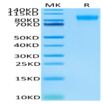 Biotinylated Human E-Selectin/CD62E Protein (ESE-HM401B)