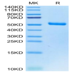 Human EVA-1/MPZL2 Protein (EVA-HM201)