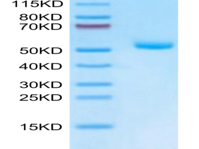 Mouse EVA-1/MPZL2 Protein (EVA-MM201)