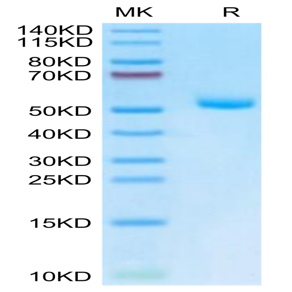 Mouse EVA-1/MPZL2 Protein (EVA-MM201) Mouse EVA-1/MPZL2 Protein (EVA-MM201)